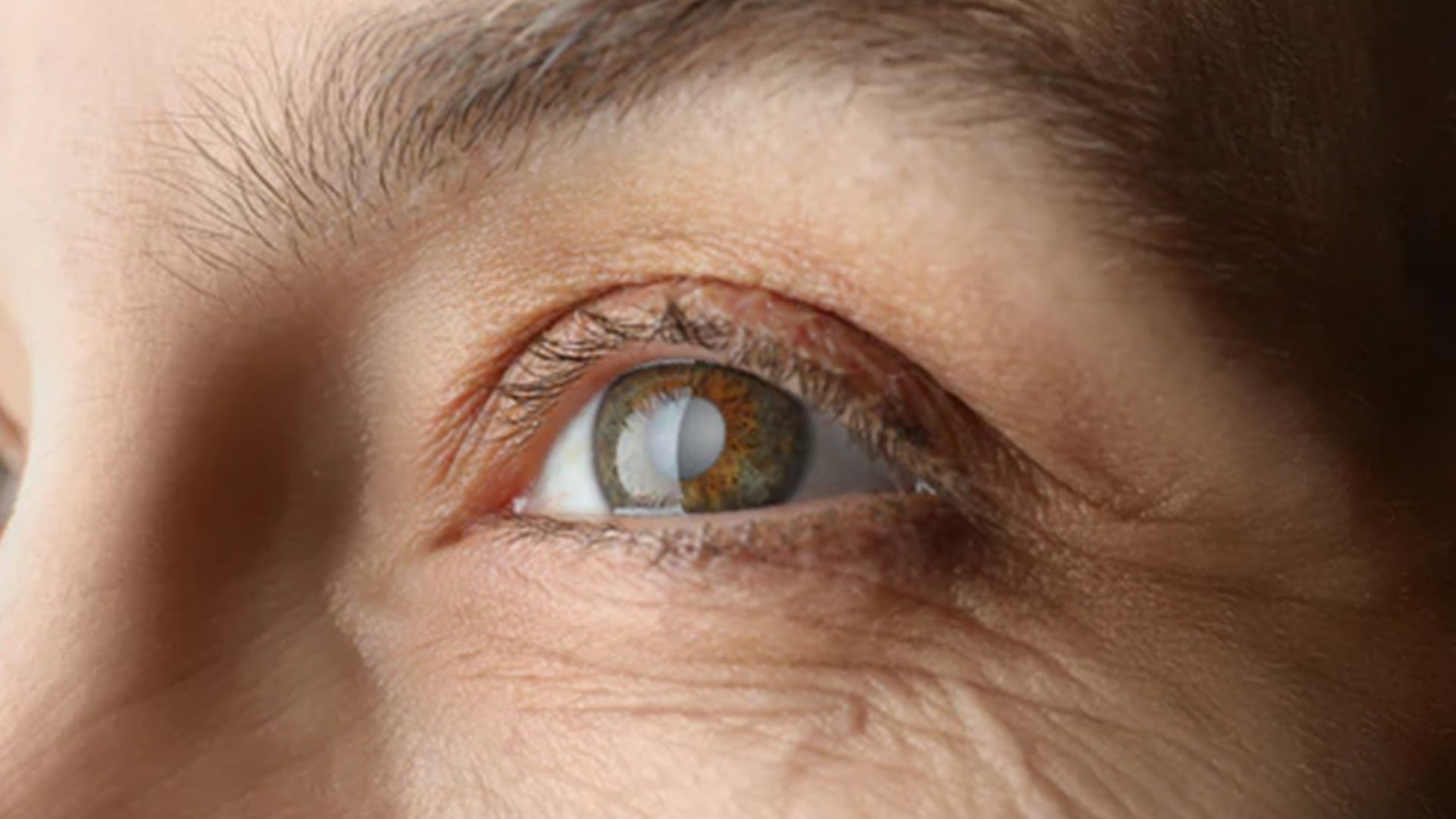 traitement cataracte des yeux cause chirurgiens ophtalmologues paris centre ophtalmologique ophtalmologie paris est traitement cataracte des yeux cause chirurgiens ophtalmologues paris centre ophtalmologique ophtalmologie paris est