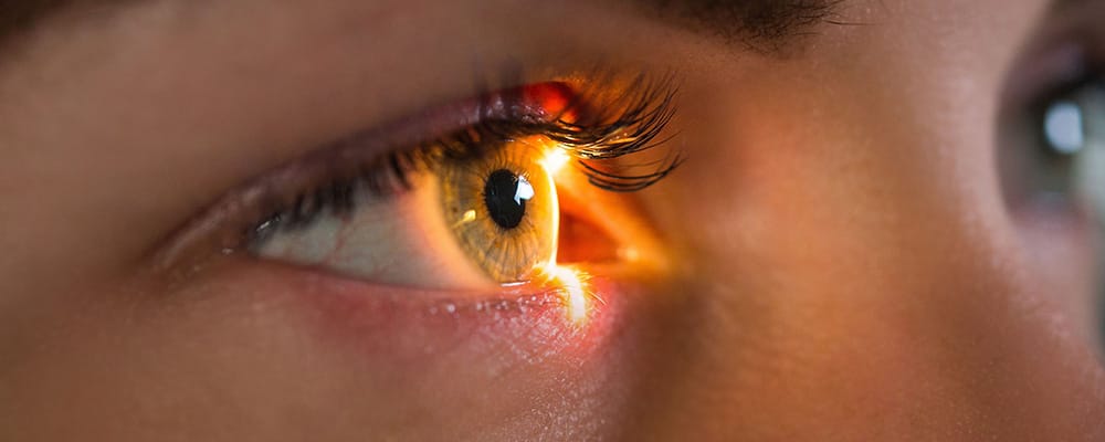 transpkr vs lasik chirurgiens ophtalmologues paris centre ophtalmologique ophtalmologie paris est transpkr vs lasik chirurgiens ophtalmologues paris centre ophtalmologique ophtalmologie paris est