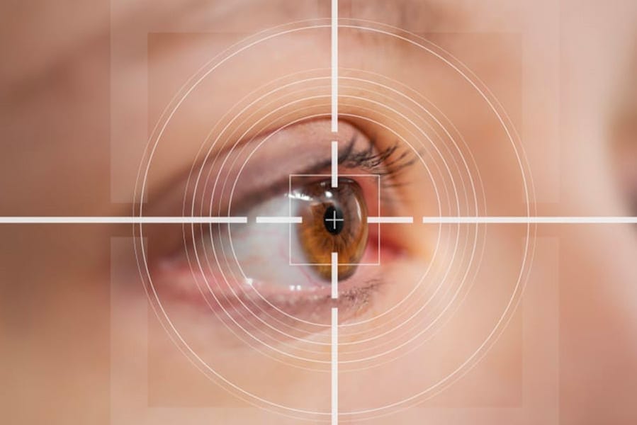 operation pkr ratee recuperation chirurgie refractive oeil ophtalmologie chirurgien ophtalmologue centre ophtalmologiste ophtalmologie paris est operation pkr ratee recuperation chirurgie refractive oeil ophtalmologie chirurgien ophtalmologue centre ophtalmologiste ophtalmologie paris est