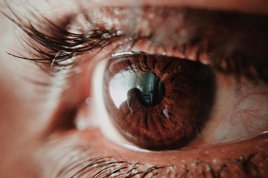 operation yeux laser hypermetrope astigmate chirurgien ophtalmologue specialiste cataracte centre ophtalmologiste ophtalmologie paris est