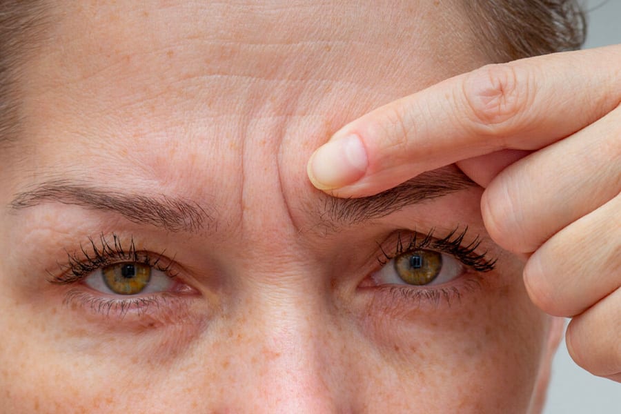 ride du lion botox ou acide hyaluronique chirurgien ophtalmologue specialiste cataracte centre ophtalmologiste ophtalmologie paris est