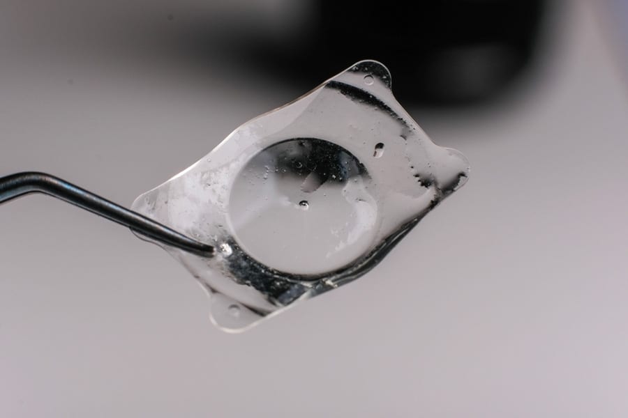 Quels sont les symptômes d&rsquo;un déplacement d&rsquo;implant cataracte ?