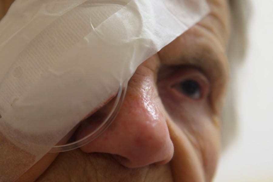 combien de temps garder la coque apres operation cataracte chirurgien ophtalmologue specialiste cataracte centre ophtalmologiste ophtalmologie paris est combien de temps garder la coque apres operation cataracte chirurgien ophtalmologue specialiste cataracte centre ophtalmologiste ophtalmologie paris est