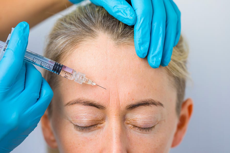 Botox pour la ride du lion : combien de temps ça dure ?