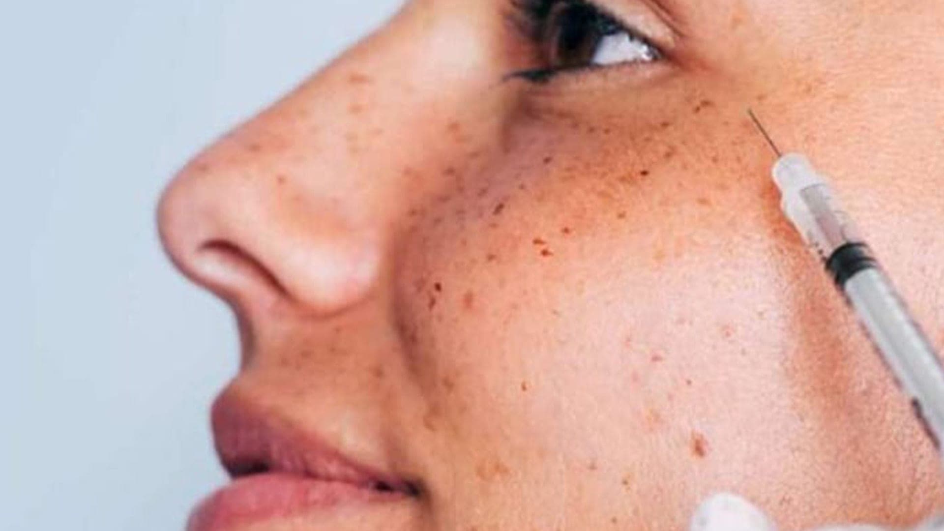 botox paris chirurgien ophtalmologue specialiste medecine esthetique centre ophtalmologiste ophtalmologie paris est